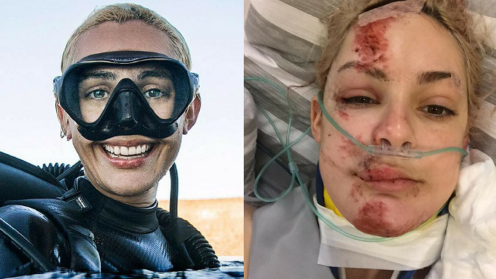 We speak exclusively to Gemma Smith about her accident, injuries, and female diving