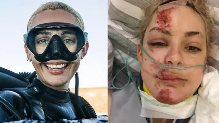 Gemma Smith Talks About Her Accident and Women In Diving